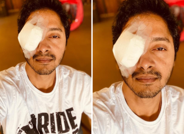 Shreyas Talpade injures his eye during lockdown, gives an update on his condition