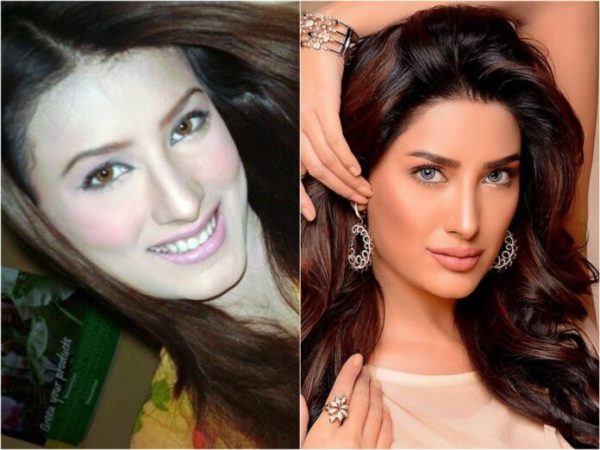 Famous Pakistani Drama Actresses Who Got Lip Fillers