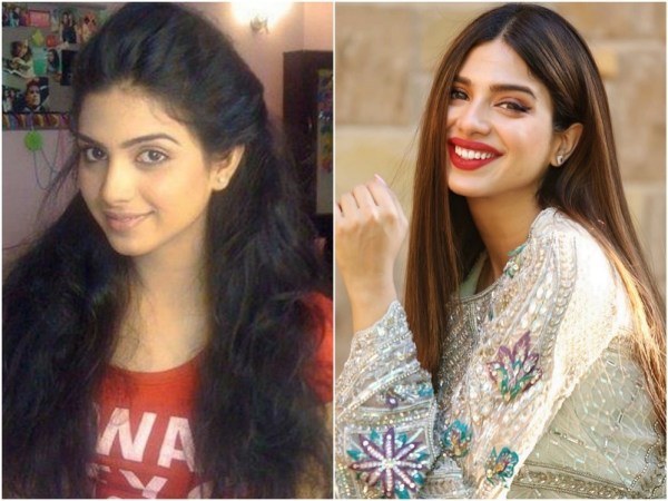 Famous Pakistani Drama Actresses Who Got Lip Fillers