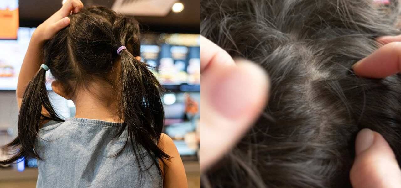 indiana mother arrested for daughters hair lice