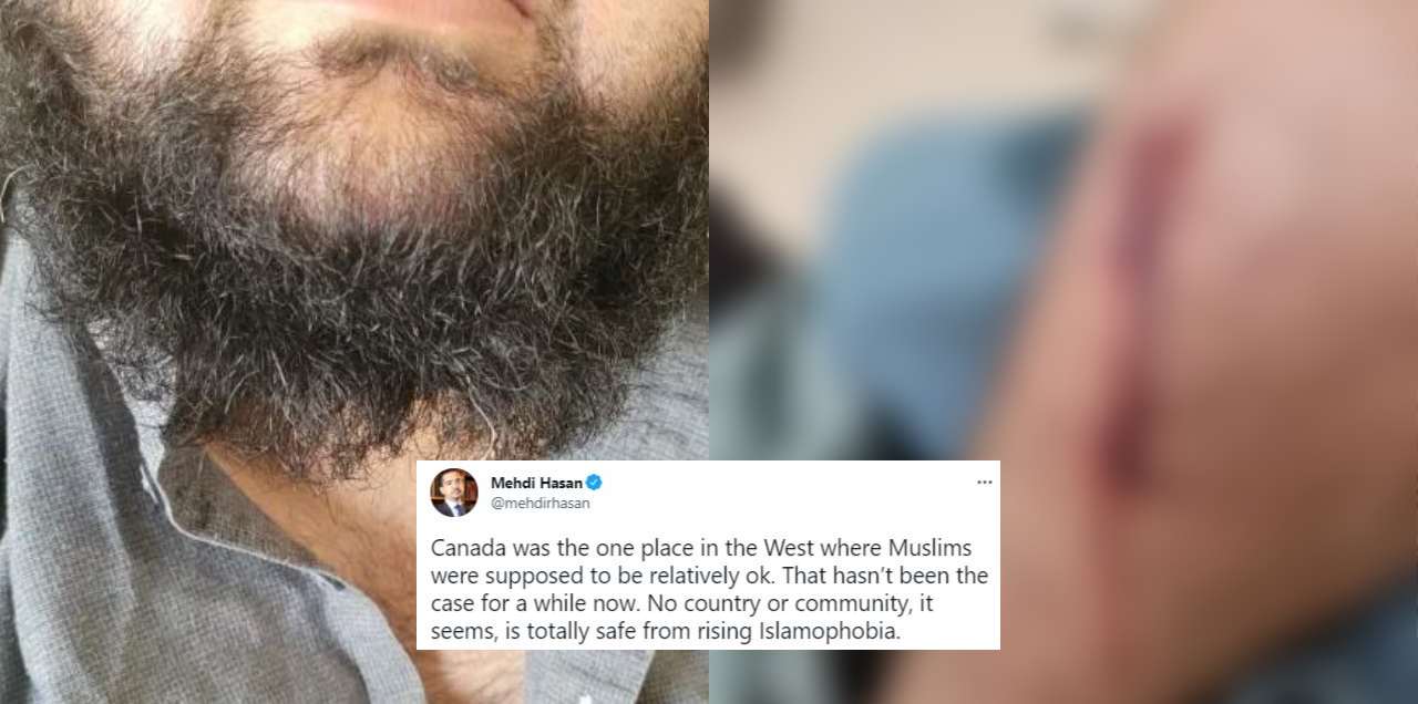 ‘I Hate Muslims’ – Pakistani Man Stabbed, Insulted Over ‘Beard & Clothing’ In Canada
