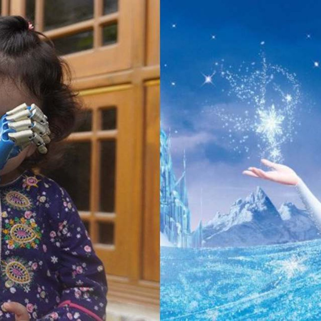 heartening-story-of-a-lil-pakistani-girl-getting-a-blue-prosthetic-arm-inspired-by-disney’s-elsa