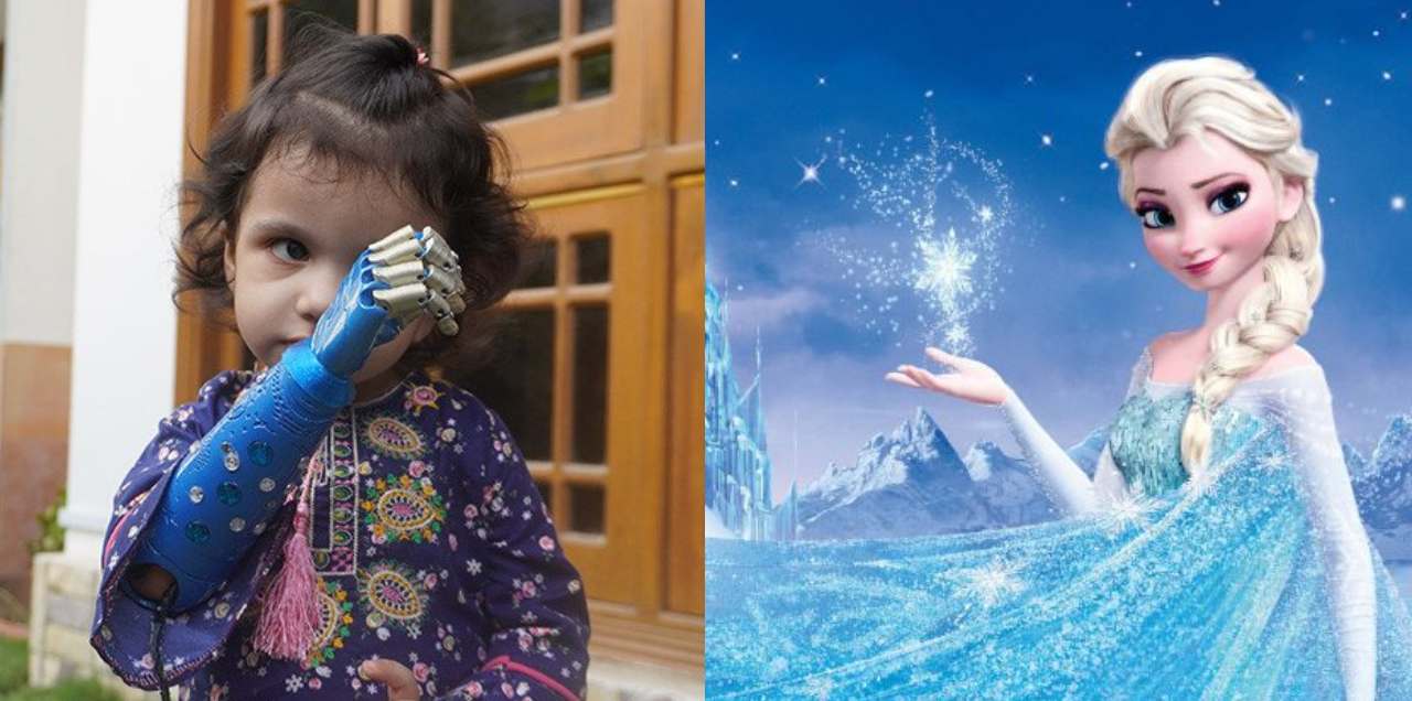 Heartening Story Of A Lil Pakistani Girl Getting A Blue Prosthetic Arm Inspired By Disney’s Elsa