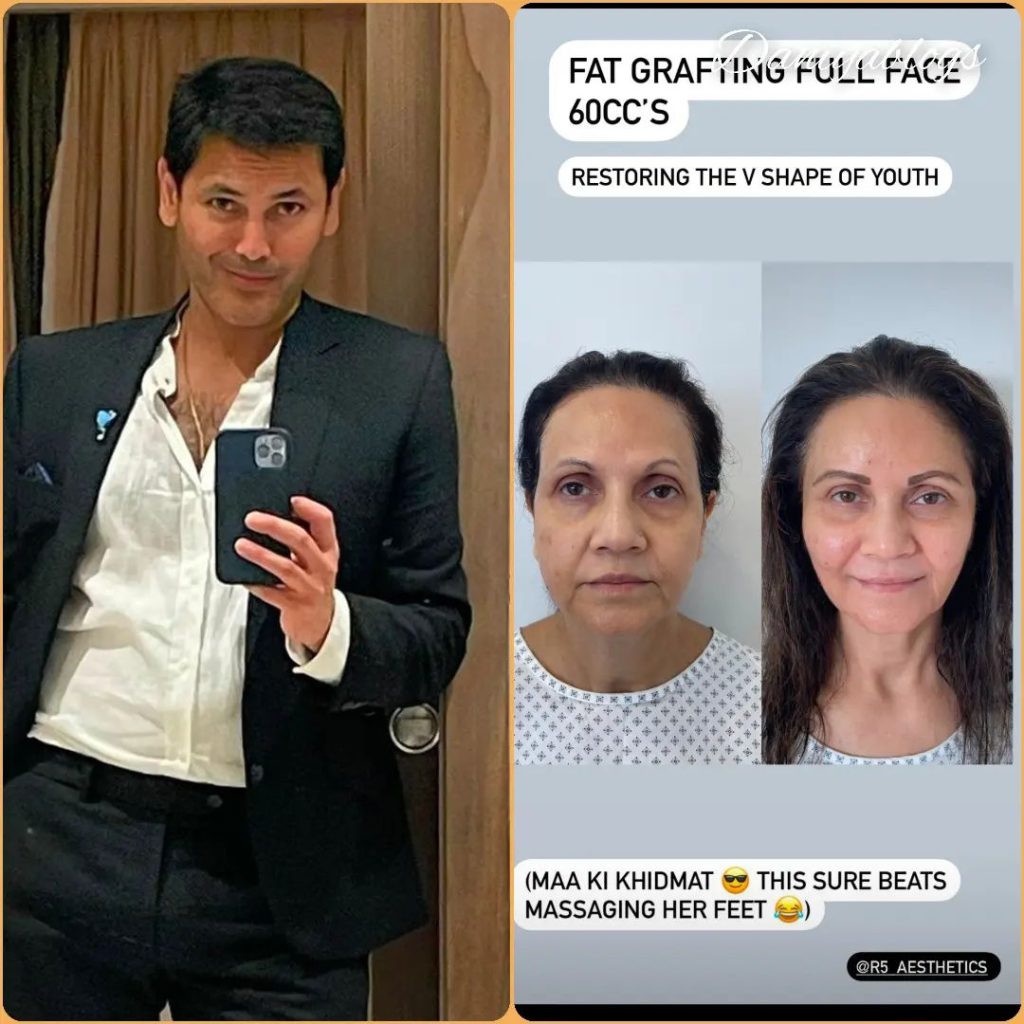 Actor & Surgeon Fahad Mirza Transforms Mother After Cosmetic Surgery