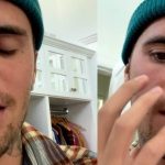 important-watch-it!-–-justin-bieber-suffering-from-partial-face-paralysis