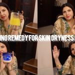 shagufta-ejaz-shares-painful-skin-condition-and-miracle-remedy