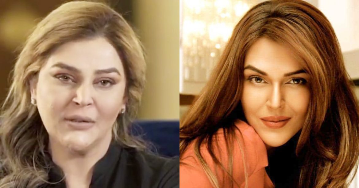 People Surprised By Drastic Changes In Sana Bucha’s Face