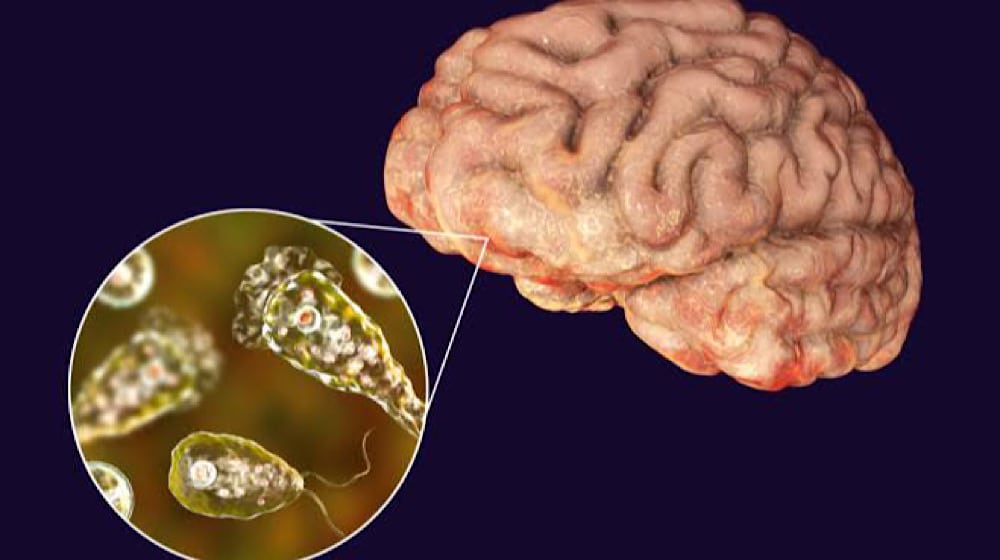 NIH Issues Alert Against Deadly Brain-Eating Amoeba