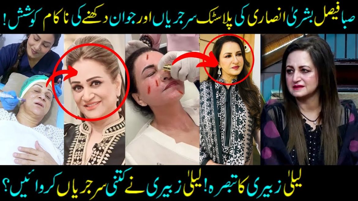 Laila Zuberi’s Take On Saba Faisal & Bushra Ansari’s Cosmetic Procedures